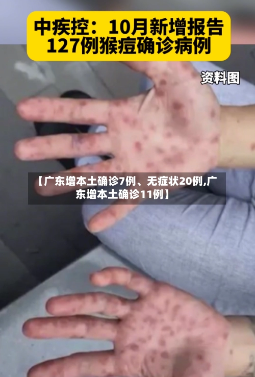 【广东增本土确诊7例	、无症状20例,广东增本土确诊11例】-第3张图片